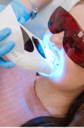 Paso 2: aplicacion del gel con luz LED