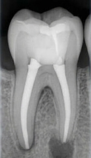 Paso 5: radiografia de control